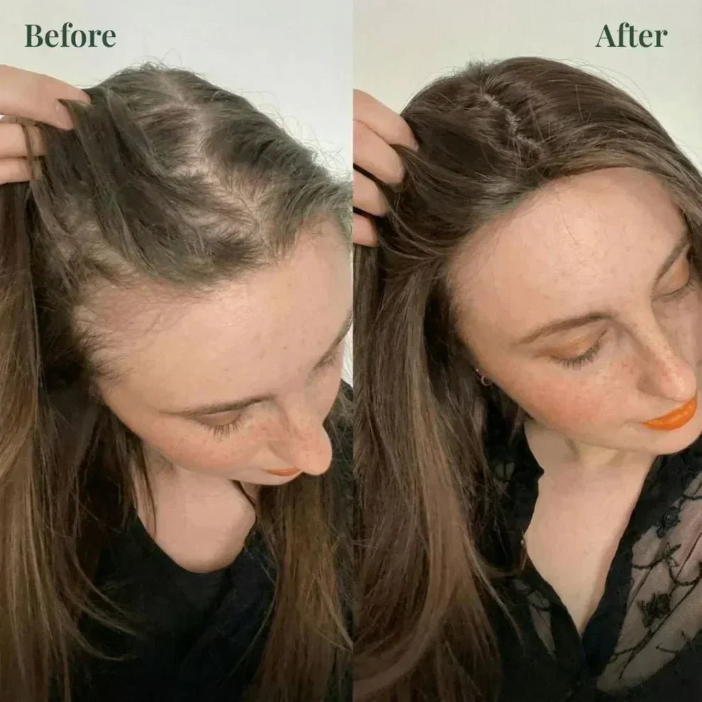 Wonder Cart Rosemary Hair Growth Shampoo – Rosemary + Keratin | Strengthens Hair & Supports Growth | Buy 1 Get 1 FREE
